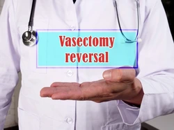 vasectomy _reversal