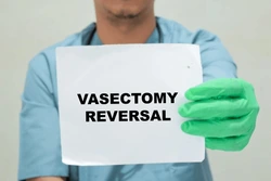Vasectomy reversal